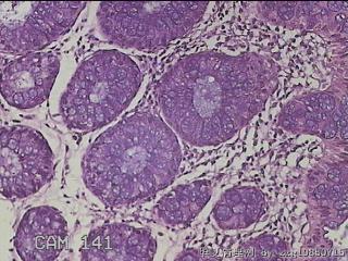直乙结肠粘膜图11