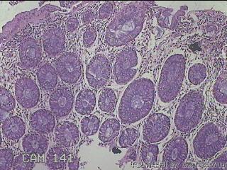 直乙结肠粘膜图5