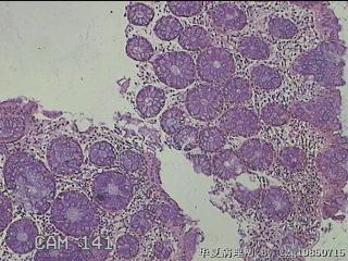 直乙结肠粘膜图2