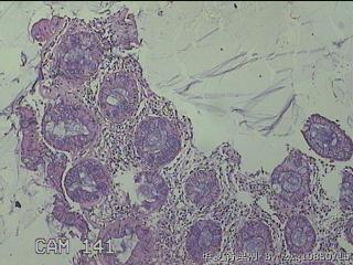直乙结肠粘膜图7
