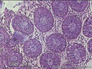直乙结肠粘膜图17