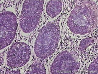 直乙结肠粘膜图13