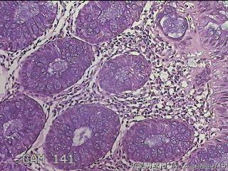 直乙结肠粘膜图12