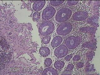 直乙结肠粘膜图1