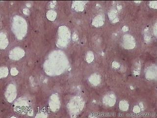 甲状腺结节细针穿刺涂片图2