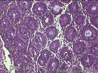 乙状结肠粘膜图17