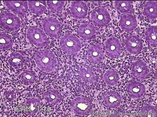 乙状结肠粘膜图32