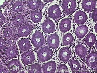乙状结肠粘膜图18