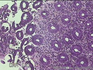 乙状结肠粘膜图21