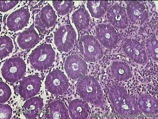 乙状结肠粘膜图13