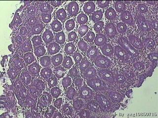 乙状结肠粘膜图2
