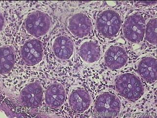 直肠粘膜图18