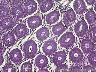 乙状结肠粘膜图15