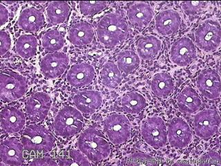 乙状结肠粘膜图30
