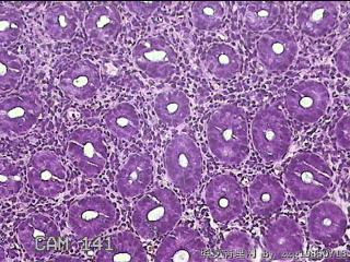 乙状结肠粘膜图25