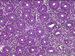乙状结肠粘膜图29