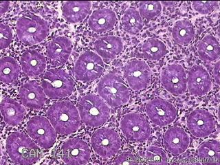 乙状结肠粘膜图31