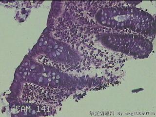 乙状结肠粘膜图20