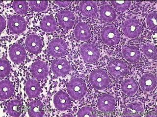 乙状结肠粘膜图27