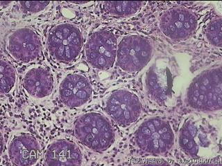 直肠粘膜图20