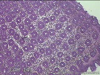 乙状结肠粘膜图4