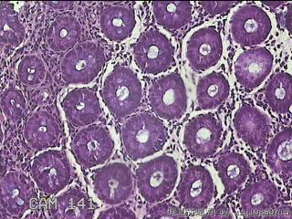 乙状结肠粘膜图16