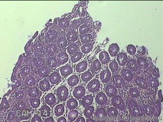 乙状结肠粘膜图1