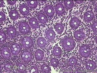 乙状结肠粘膜图28
