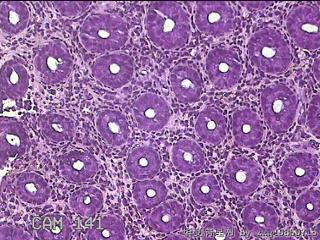 乙状结肠粘膜图22