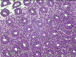 乙状结肠粘膜图23