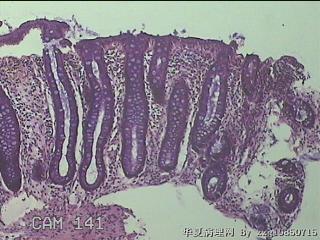 直肠粘膜图9