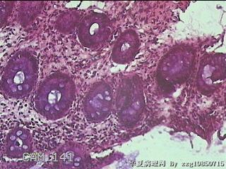 直肠粘膜图13