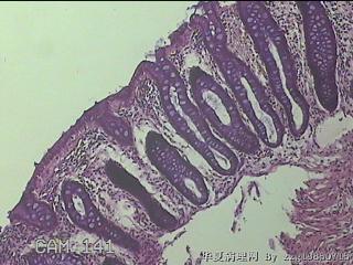 直肠粘膜图10
