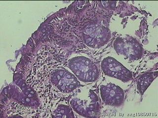 降结肠粘膜图4