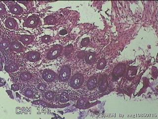直肠粘膜图3