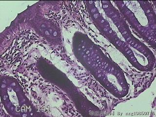 直肠粘膜图27