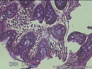降结肠粘膜图11
