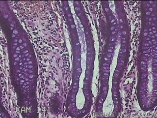 直肠粘膜图25