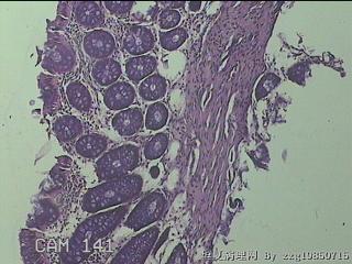 降结肠粘膜图2