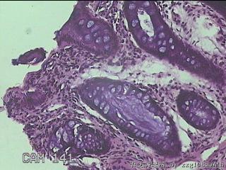 直肠粘膜图28