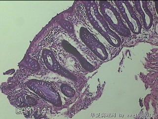 直肠粘膜图11