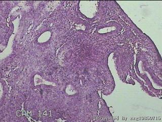 宫腔内组织图29