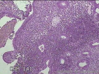 宫腔内组织图27