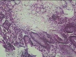 幽门管粘膜图10