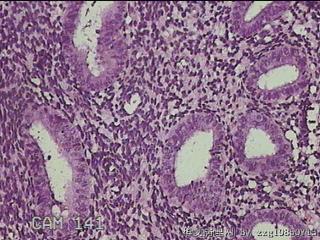 宫腔内膜图31