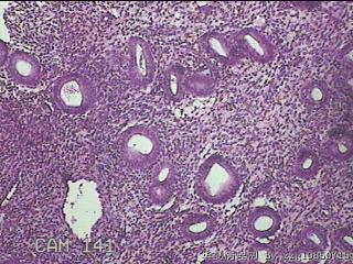 宫腔内膜图16