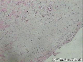 请教，右足趾第一趾赘生物图7