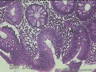 降乙结肠粘膜图3