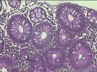降乙结肠粘膜图1