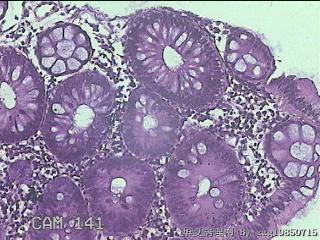 降乙结肠粘膜图6